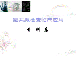 核磁共振骨科临床应用课件.ppt