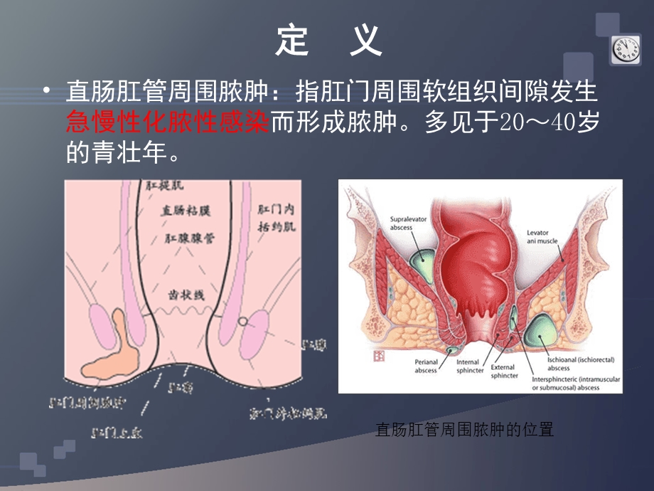 肛周脓肿CT医学ppt课件.ppt_第3页