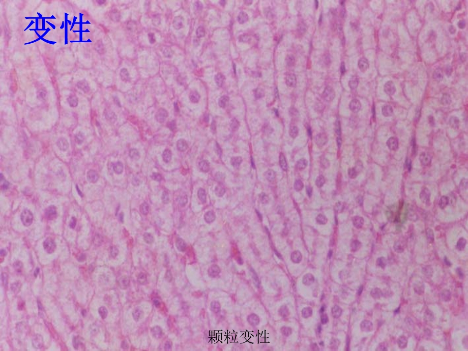 病理图片课件.ppt_第1页