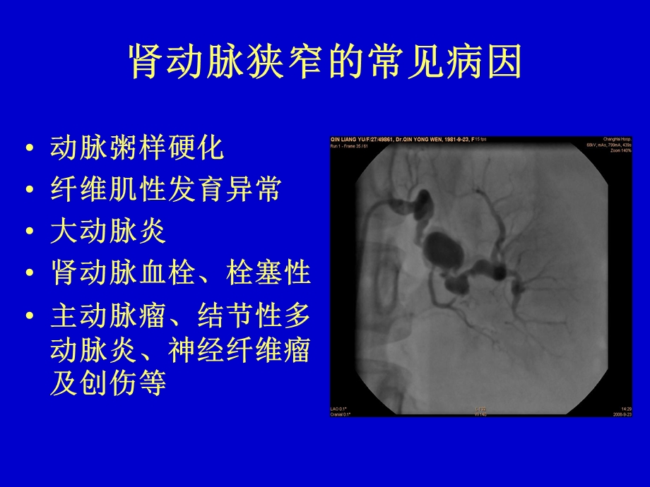 肾动脉狭窄的诊断课件.ppt_第3页