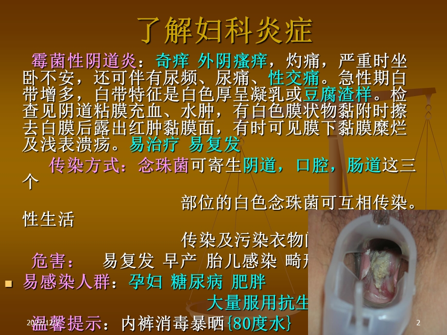 妇科疾病及炎症课件.ppt_第2页