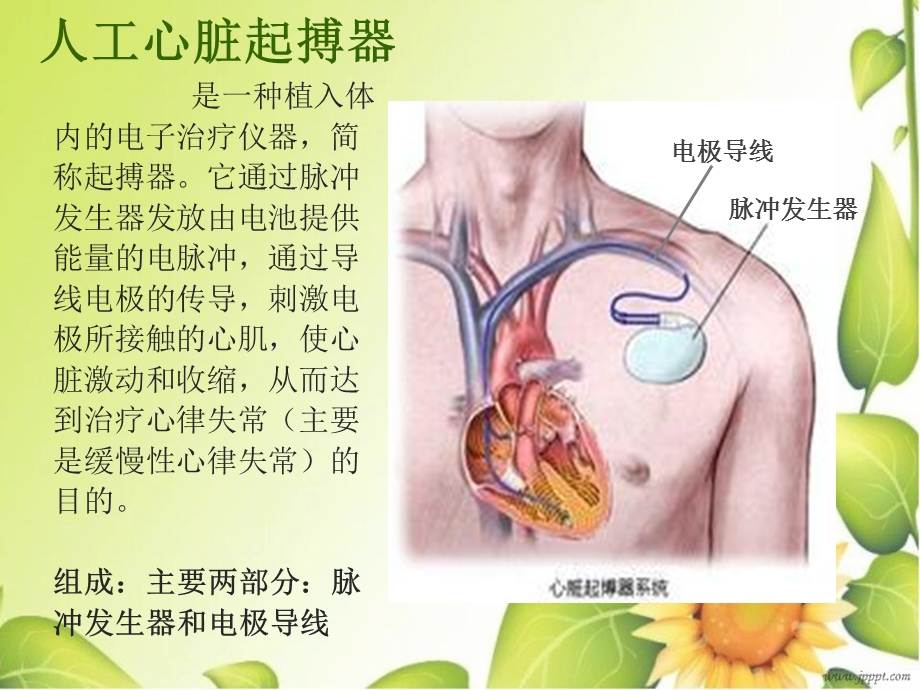 心脏永久起搏器植入术的护理课件.pptx_第3页