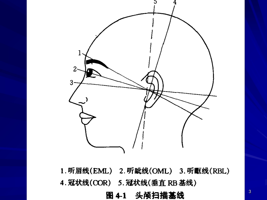 头颅CT断层解剖课件.ppt_第3页