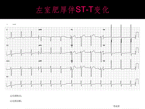 心电图考试课件.ppt