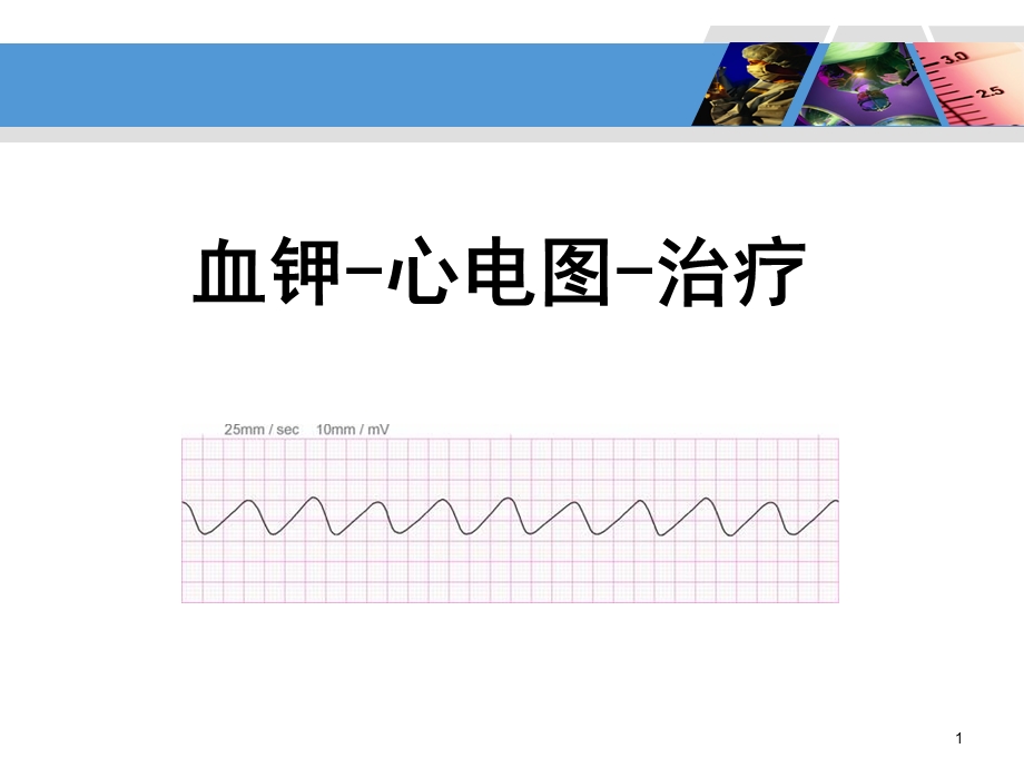 血钾心电图治疗课件.ppt_第1页