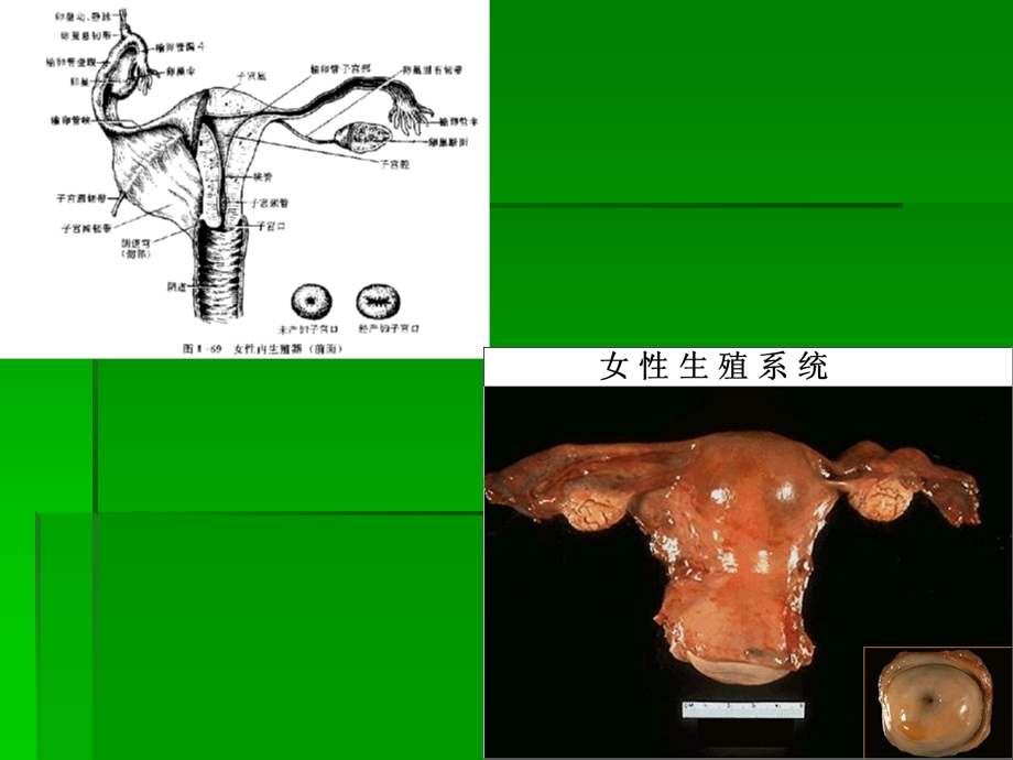 子宫颈疾病的解剖课件.ppt_第3页