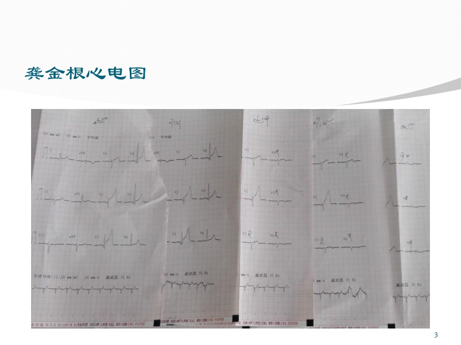 胸痛中心质量分析课件.pptx_第3页