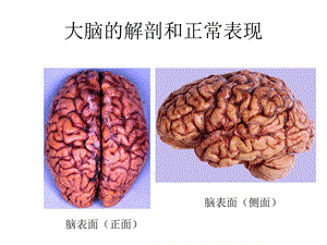 大脑解剖和正常MRI表现课件.ppt