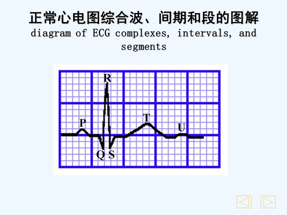 常规心电图解读课件.ppt_第3页