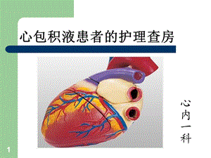 心包积液护理查房课件.ppt