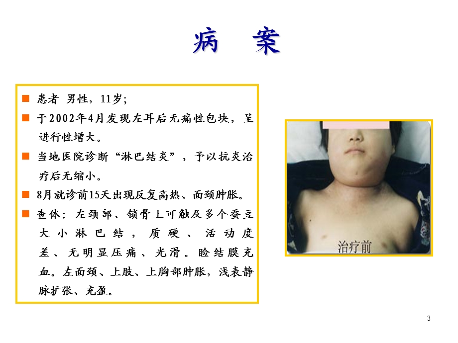 淋巴瘤课件.ppt_第3页