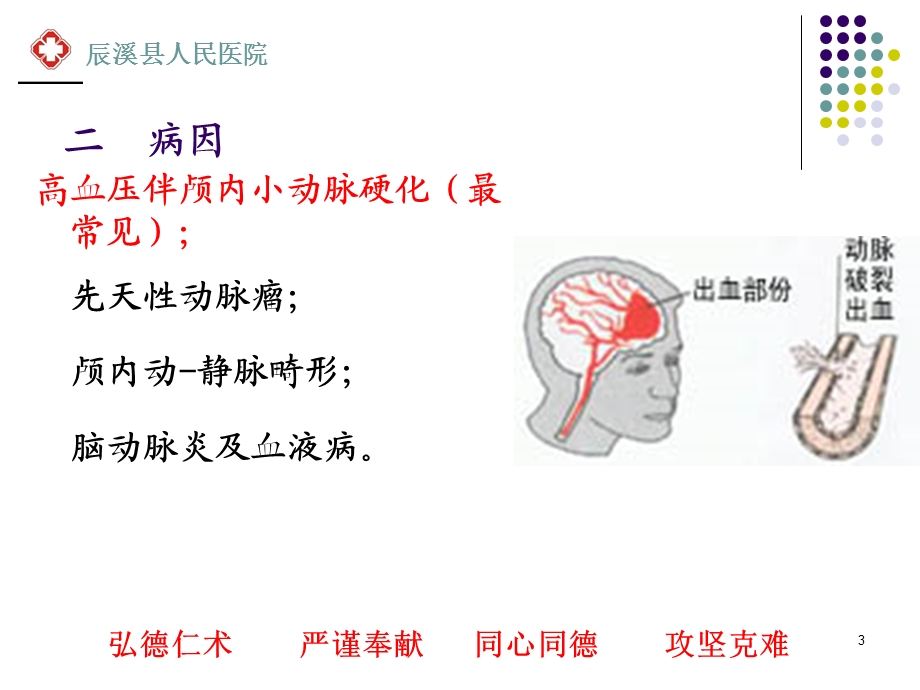 脑出血的健康教育课件.ppt_第3页