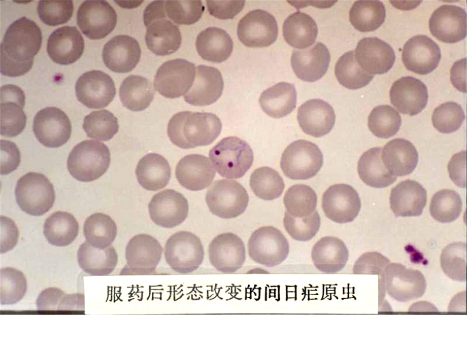 疟原虫形态照片疟原虫图片幻灯片课件.ppt_第2页