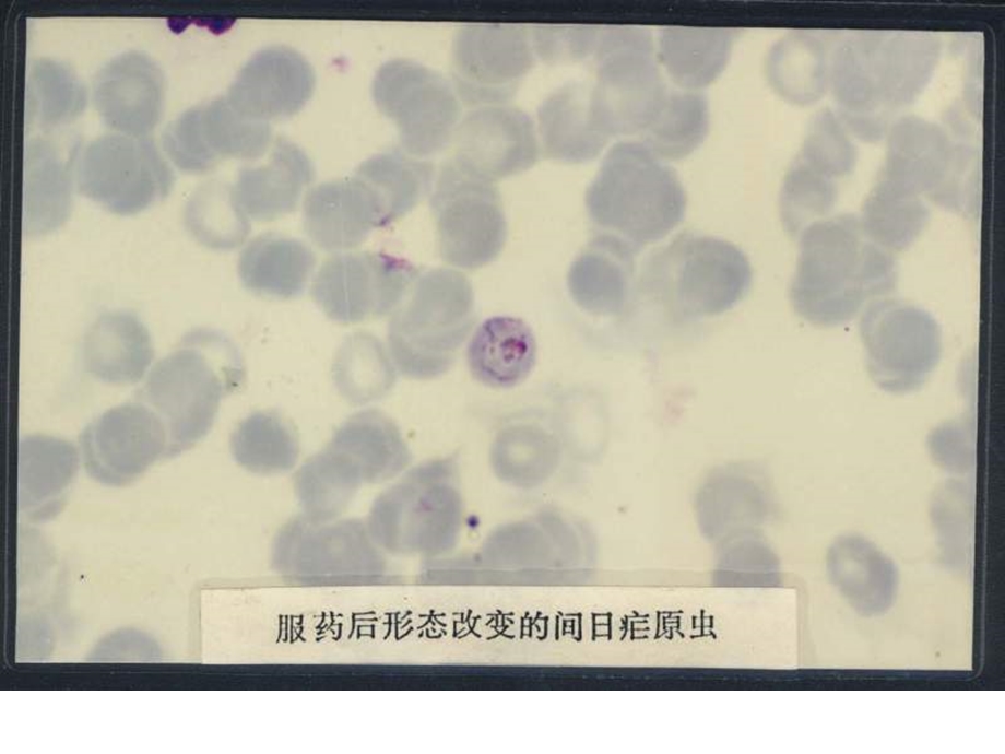 疟原虫形态照片疟原虫图片幻灯片课件.ppt_第3页