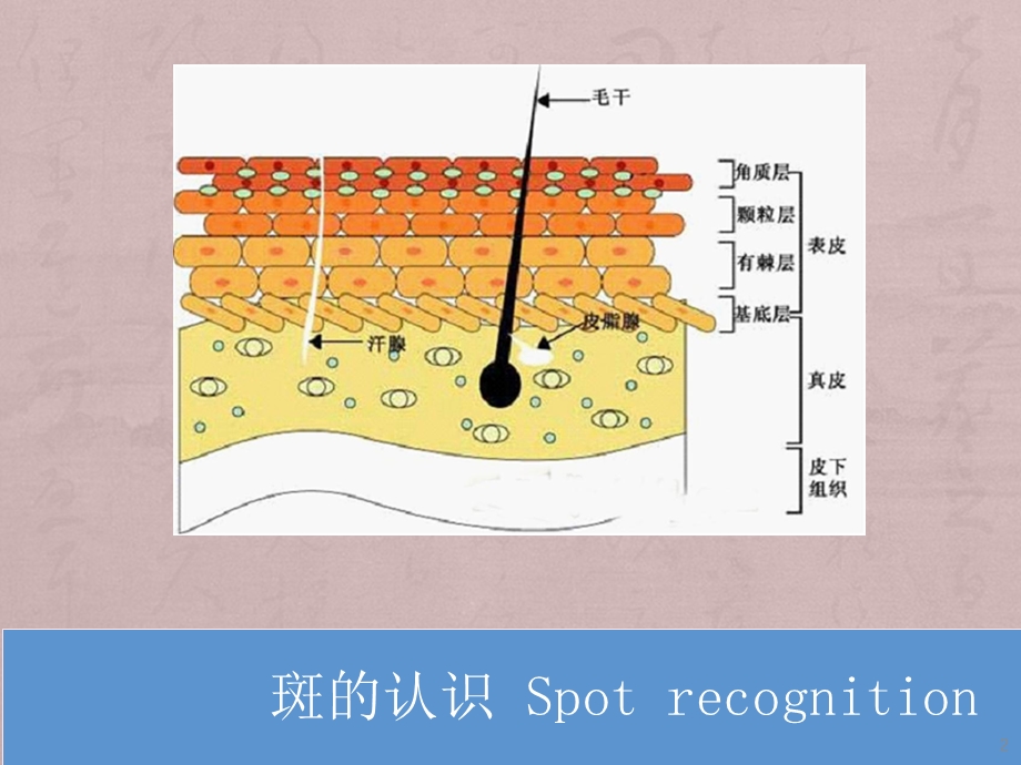 斑的认识课件.ppt_第2页