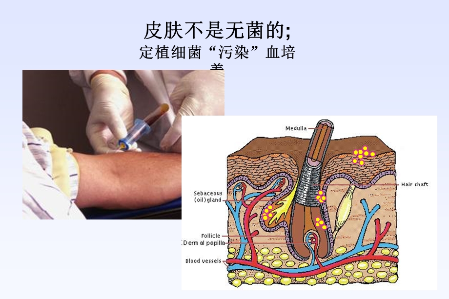 血培养操作规范与临床意义课件.ppt_第2页