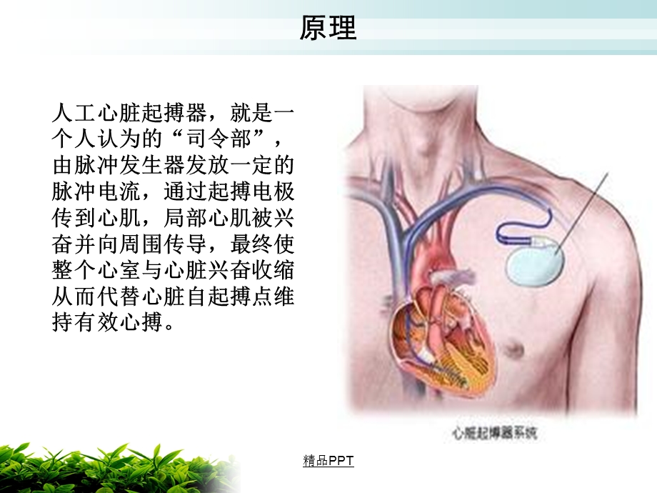 起搏器植入术的健康教育课件.ppt_第3页