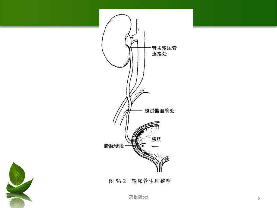 外科学泌尿系结石最新课件.ppt_第3页