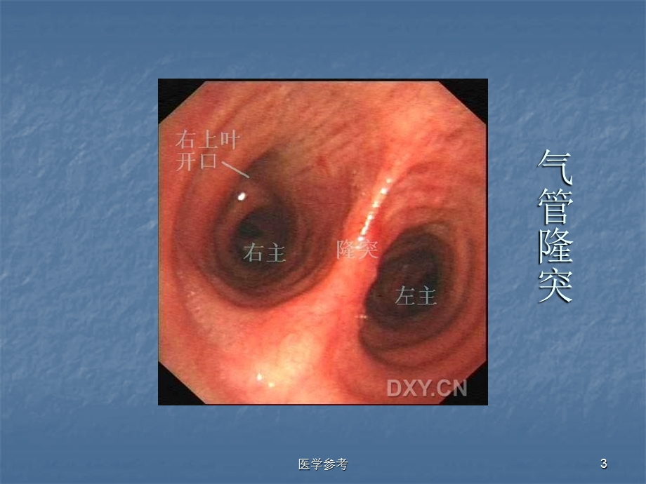 支气管镜图谱(内容充实)课件.ppt_第3页