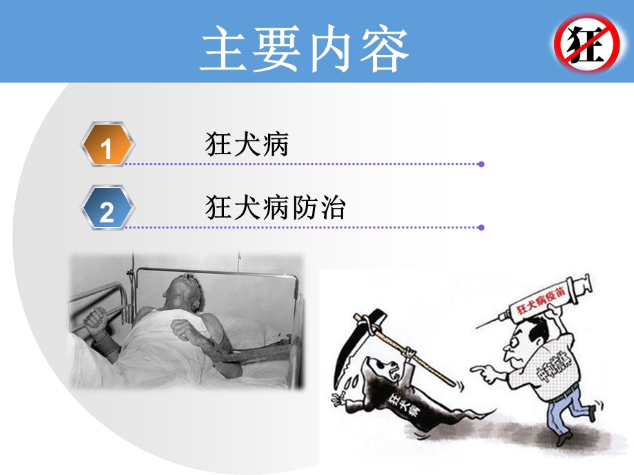 狂犬病及狂犬病防治讲解课件.ppt_第2页