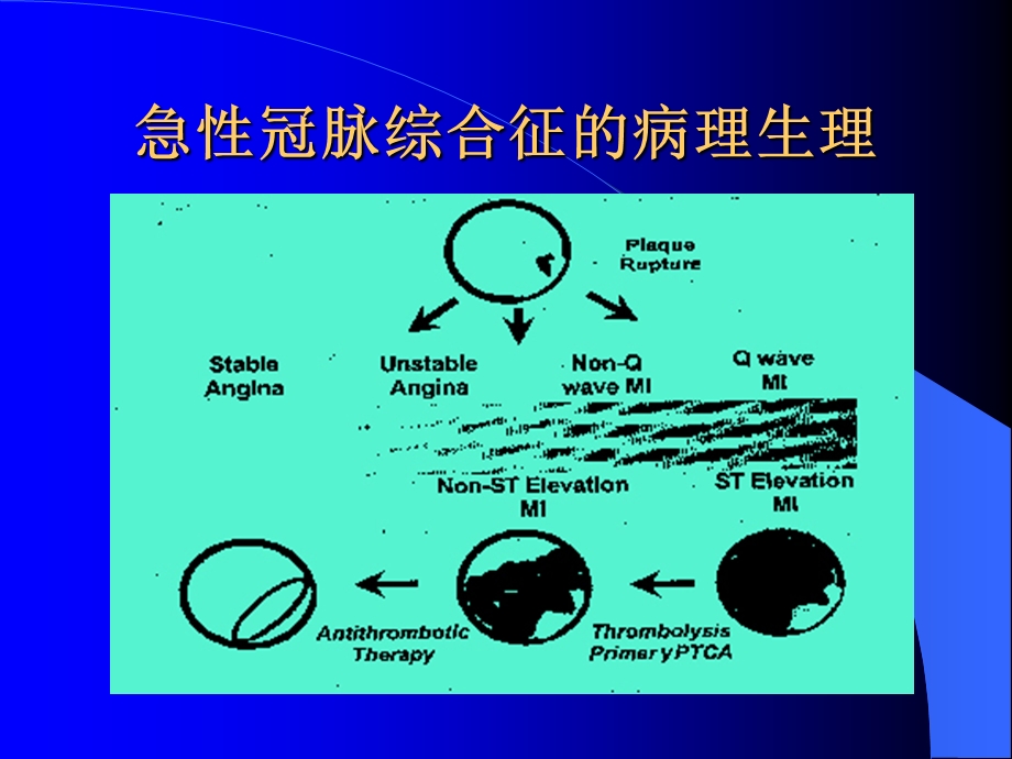 急性冠脉综合征诊断与治疗课件.ppt_第3页