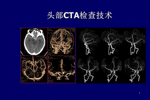 头部CTA检查技术课件.ppt