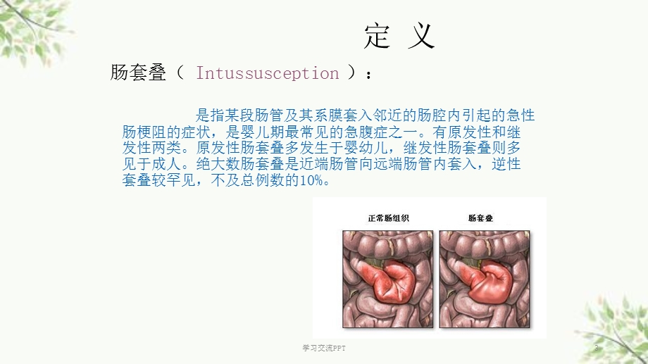 小儿肠套叠课件.ppt_第3页