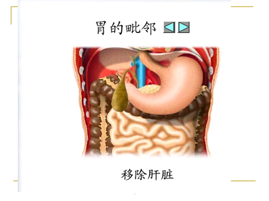 胃十二指肠疾病病人的护理课件.ppt_第3页