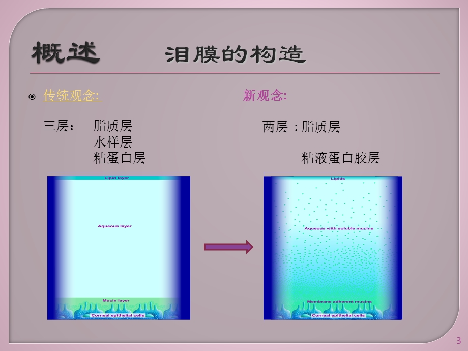 干眼症课件.pptx_第3页