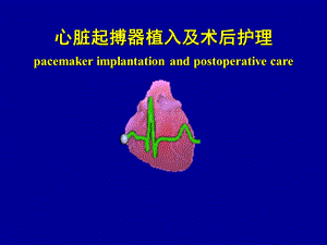 起搏器植入及术后护理课件.ppt