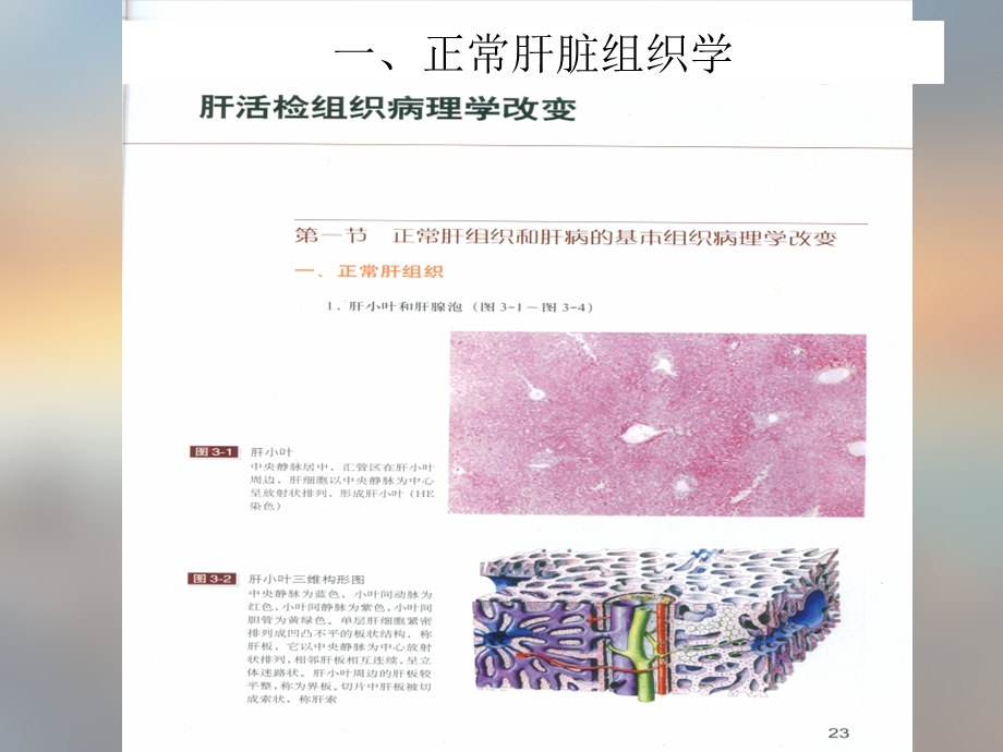 肝炎不治疗多久会演变成肝癌课件.ppt_第3页