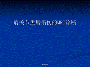 肩关节盂唇损伤的MRI诊断课件.ppt