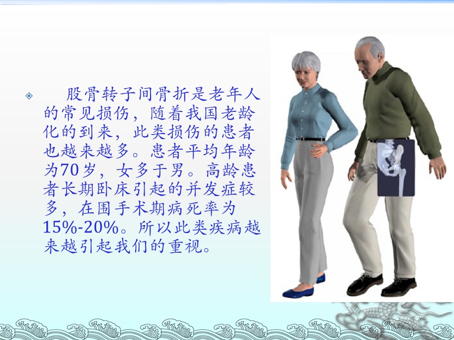 股骨转子间骨折课件.ppt_第2页