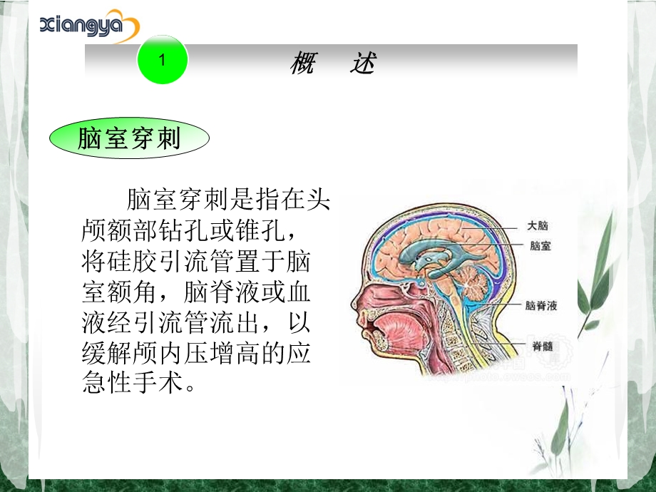 脑室引流管的护理幻灯片课件.ppt_第3页