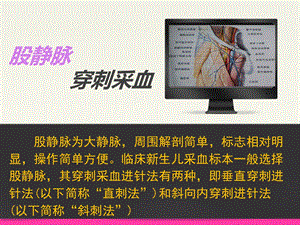 股静脉采血课件.ppt