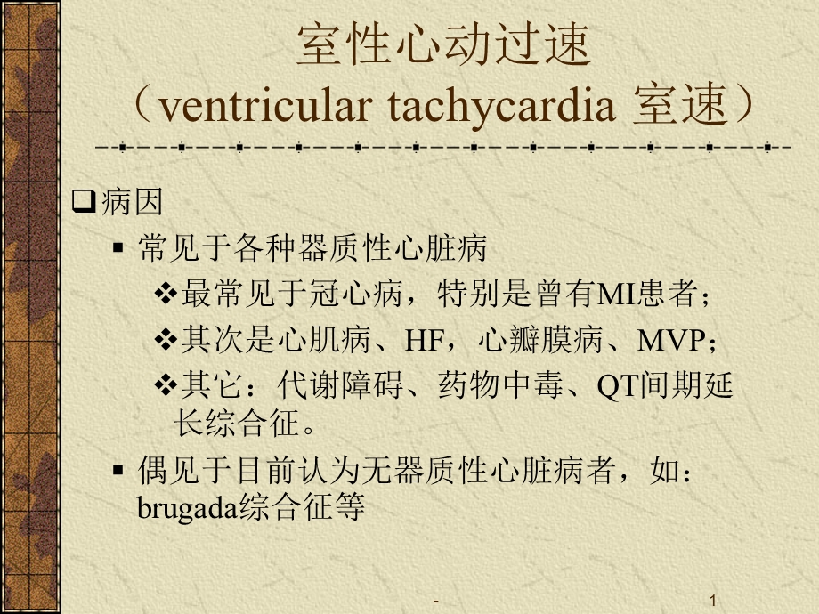 室性心动过速室速课件.ppt_第1页