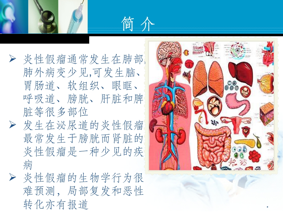 肾脏炎性假瘤影像诊断课件.ppt_第2页