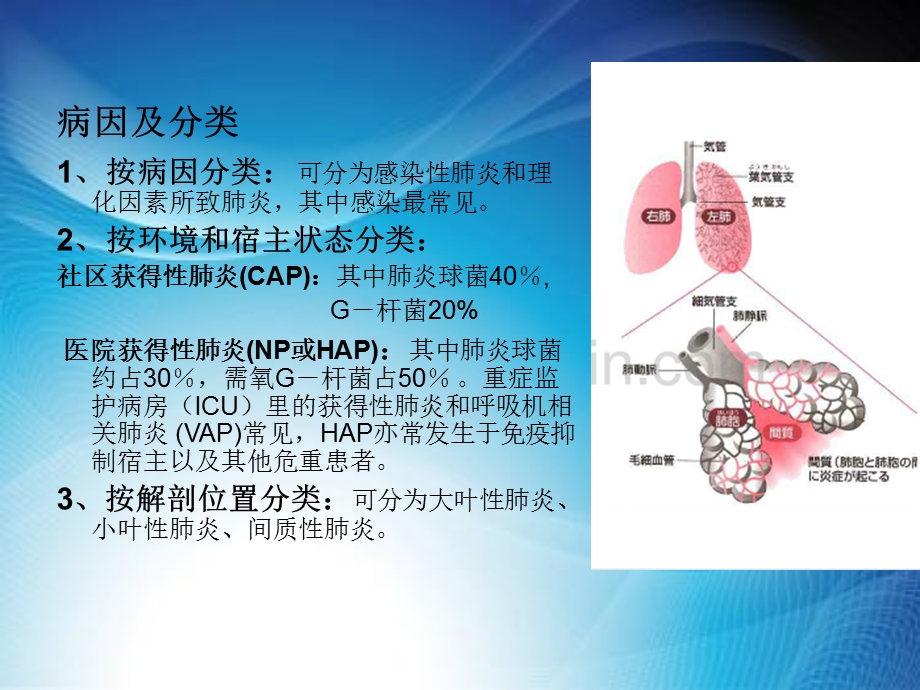 重症肺炎的护理课件.ppt_第3页