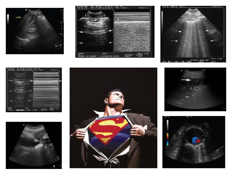 急诊床旁超声的应用详解课件.ppt_第3页