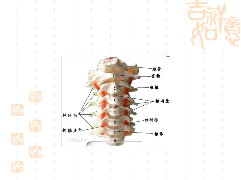 颈椎骨折病人的护理课件.ppt_第3页