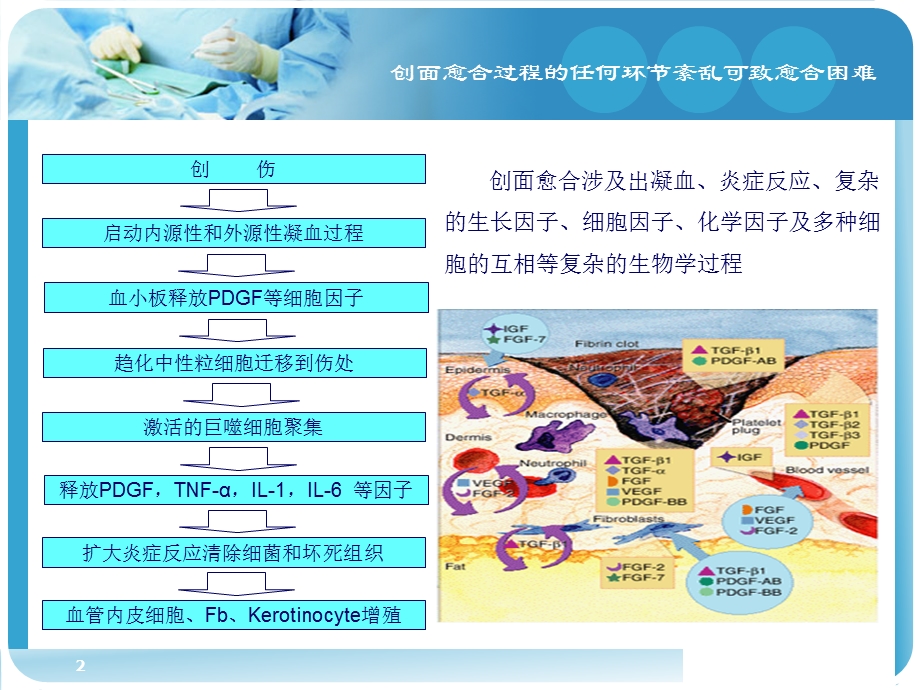 慢性难愈性创面：挑战与机遇课件.pptx_第2页