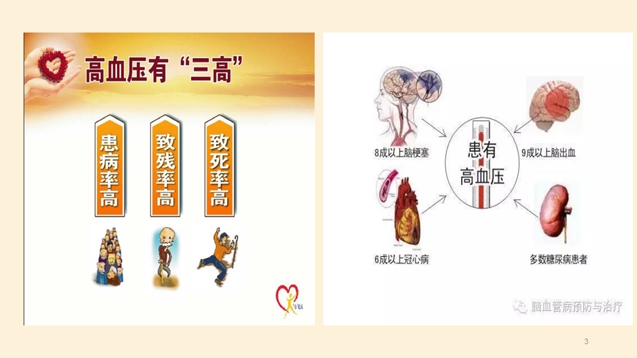 高血压病治疗与护理课件.ppt_第3页