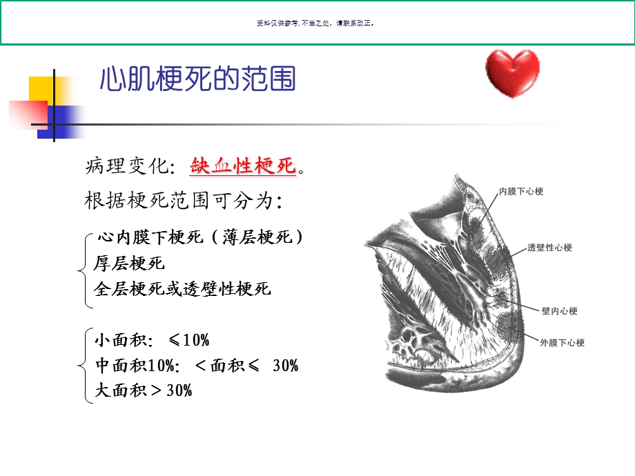 不典型心梗的心电图诊断培训讲义课件.ppt_第2页