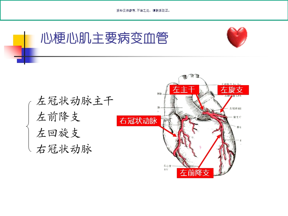 不典型心梗的心电图诊断培训讲义课件.ppt_第3页