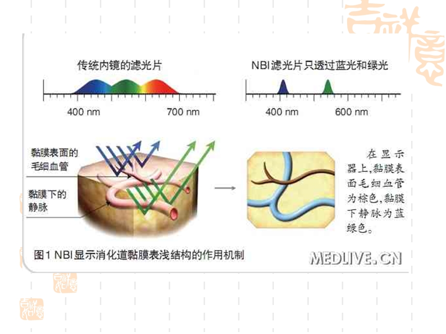 NBI内镜在消化道早癌诊断中应用课件.ppt_第3页