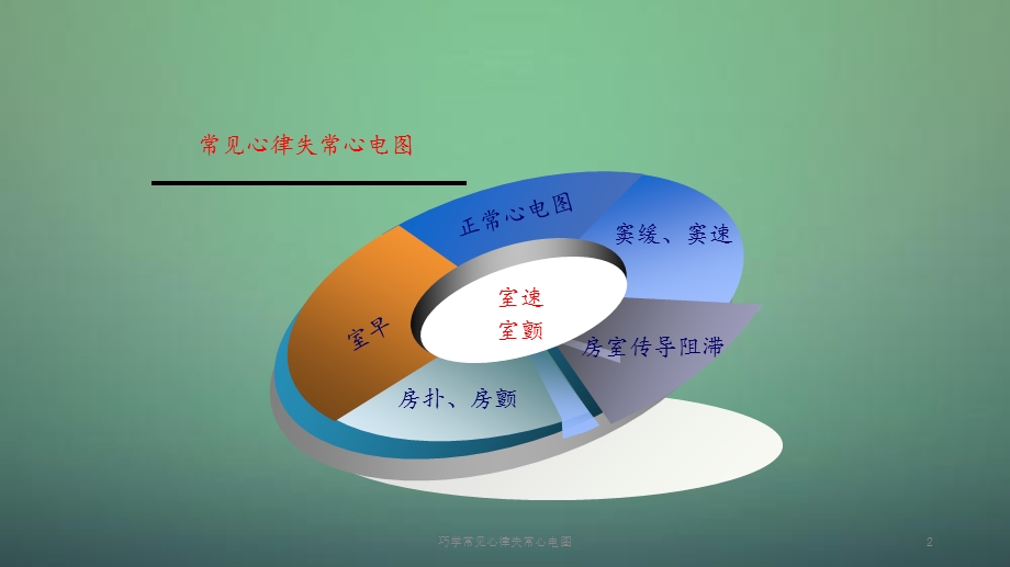 2020年巧学常见心律失常心电图（课件）.ppt_第2页