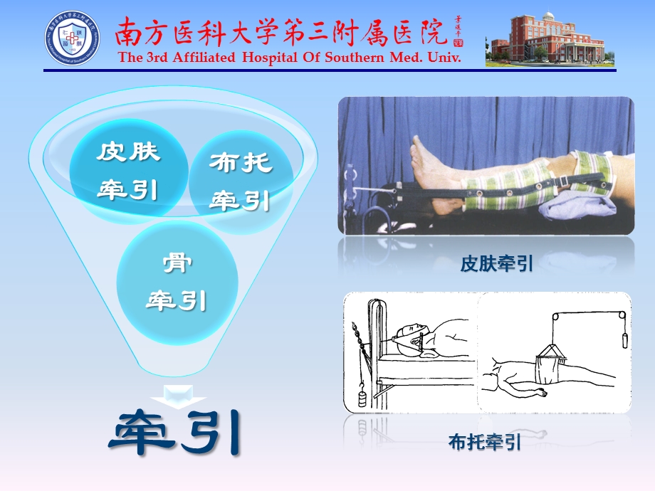 颅骨牵引的护理课件.ppt_第2页