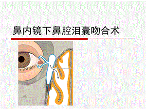 鼻内镜鼻腔泪囊吻合术医学ppt课件.ppt