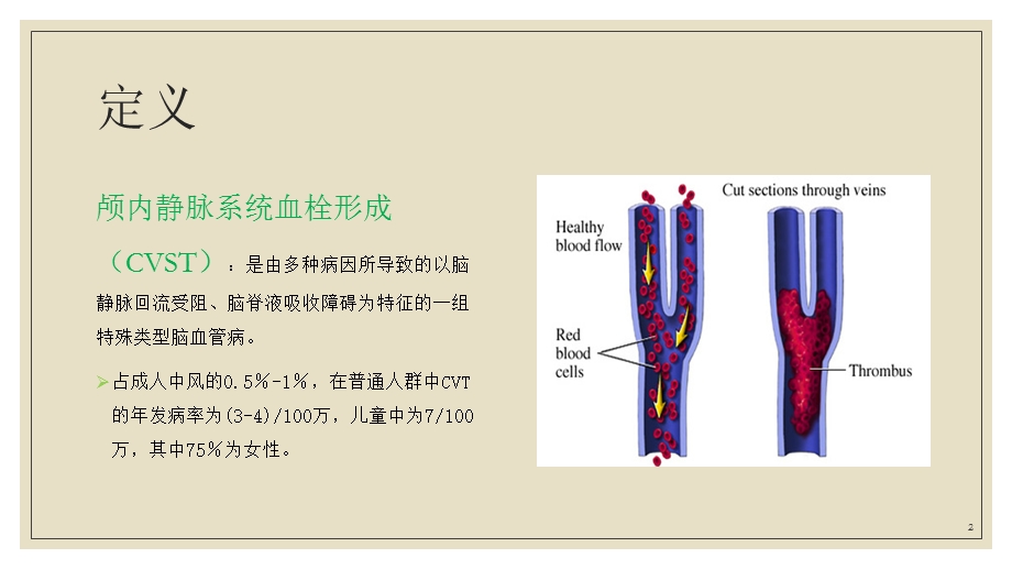 颅内静脉窦血栓课件.pptx_第2页