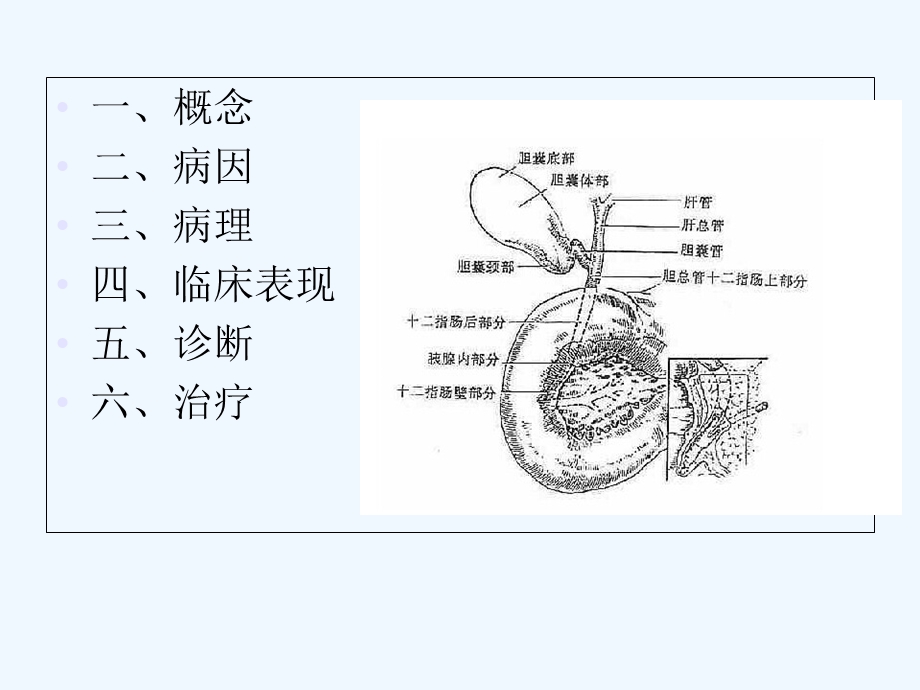 急性梗阻性化脓性胆管炎课件.ppt_第2页